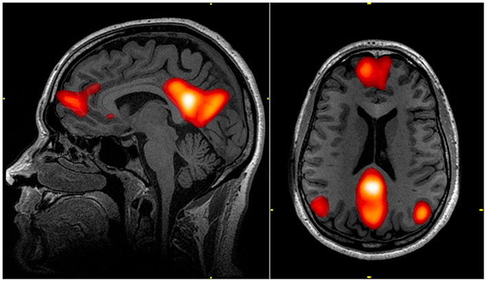 Default mode network image